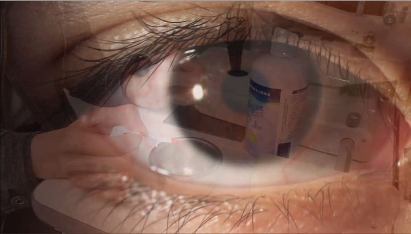 A close-up, double exposure image of an eye, overlaid with a hand holding a contact lens and a bottle of contact lens