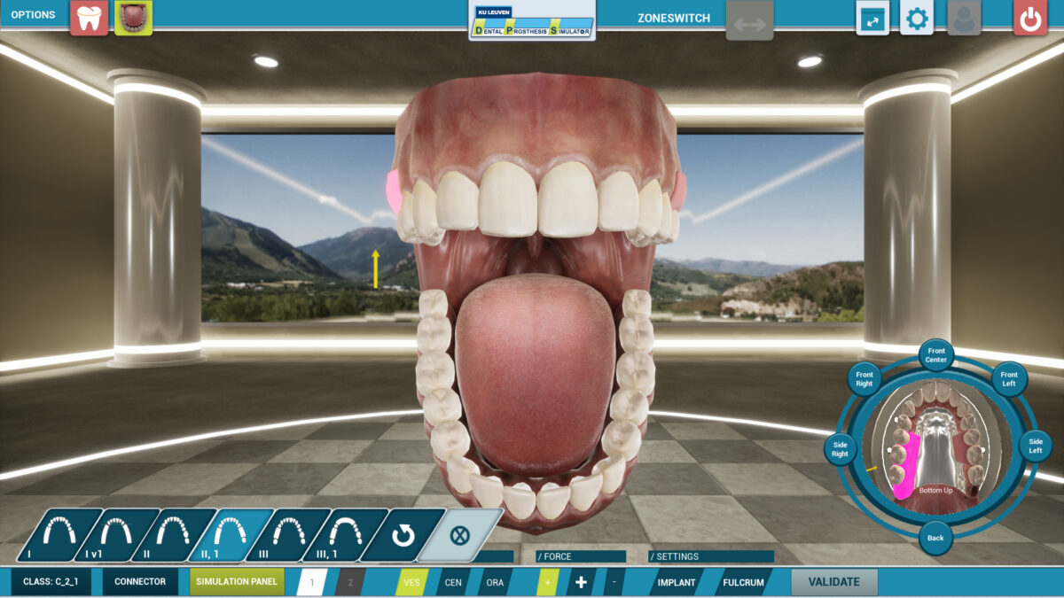 Screenshot of a dental prosthesis simulator showing an open mouth with teeth and gums, and UI elements.
